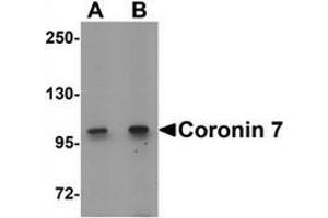 Western blot analysis of Coronin 7 in rat lung tissue lysate with Coronin 7 antibody at (A) 1 and (B) 2 ug/mL.