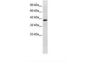 Image no. 1 for anti-Transcription Factor EB (TFEB) (AA 170-219) antibody (ABIN6736030) (TFEB Antikörper  (AA 170-219))