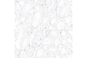 Immunohistochemistry of paraffin-embedded Human kidney (negative control sample) using CD19 antibody (ABIN7266169) at dilution of 1:10000 (40x lens). (CD19 Antikörper)