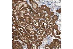 Immunohistochemical staining of human kidney with SLC35E1 polyclonal antibody  shows cytoplasmic positivity in renal tubules at 1:200-1:500 dilution. (SLC35E1 Antikörper)