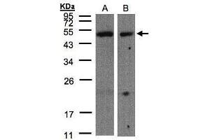 WB Image Sample(30 μg of whole cell lysate) A:A431, B:Hep G2, 10% SDS PAGE antibody diluted at 1:500 (CARD8 Antikörper  (C-Term))