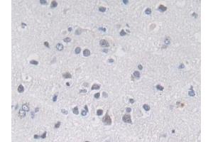Immunohistochemistry (IHC) image for anti-E3 ubiquitin-protein ligase MIB2 (MIB2) (AA 687-930) antibody (ABIN7439483)