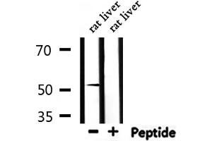 Western Blotting (WB) image for anti-Nuclear Receptor Subfamily 0, Group B, Member 1 (NR0B1) (Internal Region) antibody (ABIN6263711)