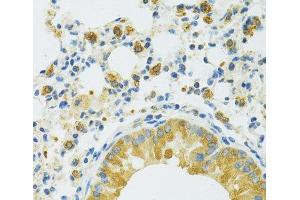 Immunohistochemistry of paraffin-embedded Mouse lung using SLC37A4 Polyclonal Antibody at dilution of 1:100 (40x lens).