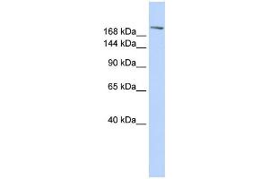 WB Suggested Anti-CCNB3 Antibody Titration:  0. (Cyclin B3 Antikörper  (C-Term))