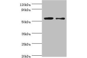 Western blot All lanes: PGD antibody at 2 μg/mL Lane 1: EC109 whole cell lysate Lane 2: 293T whole cell lysate Secondary Goat polyclonal to rabbit IgG at 1/15000 dilution Predicted band size: 54, 52 kDa Observed band size: 54 kDa (PGD Antikörper  (AA 4-483))