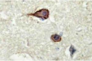 Immunohistochemistry analysis of EMMPRIN Antibody in paraffin-embedded human brain tissue. (CD147 Antikörper)