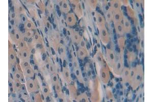 IHC-P analysis of Mouse Stomach Tissue, with DAB staining. (GREM1 Antikörper  (AA 25-184))