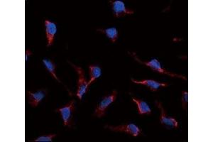 Immunofluorescence analysis of SCF antibody and HeLa cells.
