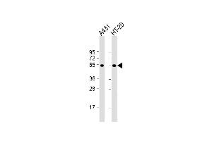 All lanes : Anti-p53 Antibody  at 1:2000 dilution Lane 1: A431 whole cell lysate Lane 2: HT-29 whole cell lysate Lysates/proteins at 20 μg per lane. (p53 Antikörper  (AA 293-322))