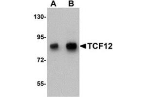 Western blot analysis of TCF12 in HeLa cell lysate with TCF12 antibody at (A) 0. (TCF12 Antikörper  (N-Term))