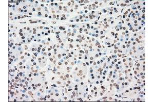 Immunohistochemical staining of paraffin-embedded colon tissue using anti-CHEK2mouse monoclonal antibody. (CHEK2 Antikörper)