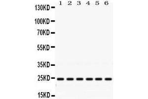 Western Blotting (WB) image for anti-RAB5A, Member RAS Oncogene Family (RAB5A) (AA 179-215), (C-Term) antibody (ABIN3043917) (RAB5 Antikörper  (C-Term))