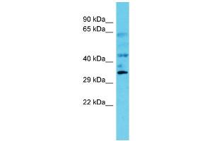 Host: Rabbit Target Name: C6orf106 Sample Type: Fetal Kidney lysates Antibody Dilution: 1. (C6orf106 Antikörper  (C-Term))