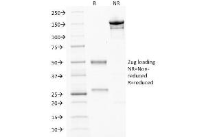 SDS-PAGE Analysis Purified CDX2 Mouse Monoclonal Antibody (CDX2/2214).