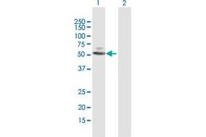 Western Blot analysis of PARP15 expression in transfected 293T cell line by PARP15 MaxPab polyclonal antibody. (PARP15 Antikörper  (AA 1-444))