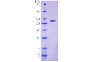 SDS-PAGE (SDS) image for Arachidonate 12-Lipoxygenase, 12R Type (ALOX12B) (AA 479-701) protein (His tag) (ABIN6239243)