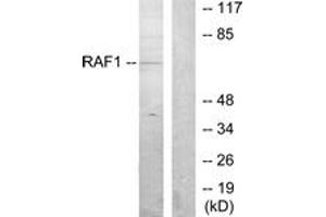 Western blot analysis of extracts from K562 cells, using C-RAF (Ab-259) Antibody. (RAF1 Antikörper  (AA 225-274))