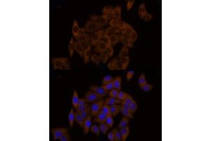 Immunofluorescence analysis of HeLa cells using GSDMD (Full Length+N terminal) Rabbit pAb (ABIN7267351) at dilution of 1:150 (40x lens).