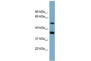 WB Suggested Anti-ADAMDEC1 Antibody Titration: 0.