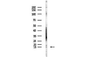 Western blot analysis of lysates from LoVo cells(heat-shock,45 min treatment), using CYTL1 Antibody at 1/1000 dilution.