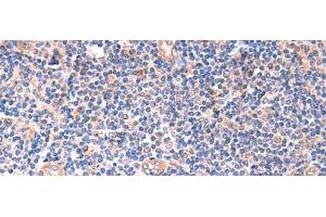 Immunohistochemistry of paraffin-embedded Human tonsil tissue using ZNF256 Polyclonal Antibody at dilution of 1:120(x200) (ZNF256 Antikörper)
