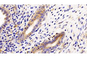 Detection of gp130 in Rat Uterus Tissue using Polyclonal Antibody to Glycoprotein 130 (gp130) (CD130/gp130 Antikörper  (AA 26-323))