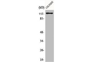 Western Blot analysis of COLO205 cells using Eg5 Polyclonal Antibody (KIF11 Antikörper)