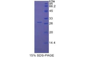 SDS-PAGE analysis of Rat LOXL1 Protein.