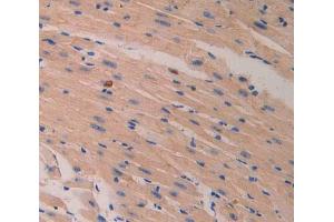 IHC-P analysis of heart tissue, with DAB staining.
