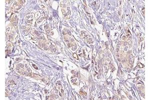 Immunohistochemistry (IHC) image for anti-ATP-Binding Cassette, Sub-Family D (Ald), Member 4 (ABCD4) (Internal Region) antibody (ABIN6257921)