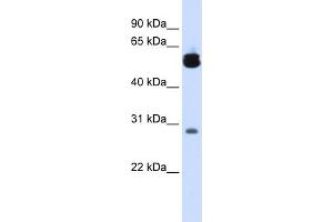 WB Suggested Anti-YWHAZ Antibody Titration:  0. (14-3-3 zeta Antikörper  (Middle Region))