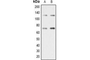 Western blot analysis of RAD21 expression in Jurkat (A), A431 (B) whole cell lysates. (RAD21 Antikörper  (C-Term))