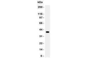 Western blot testing of Cathepsin G antibody and rat thymus lysate. (Cathepsin G Antikörper  (AA 76-255))