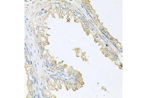 Immunohistochemistry (Paraffin-embedded Sections) (IHC (p)) image for anti-Protein Phosphatase 3, Regulatory Subunit B, alpha (PPP3R1) (AA 11-170) antibody (ABIN1682270)