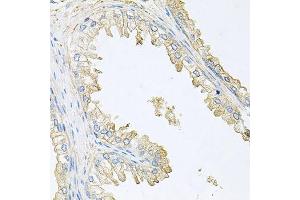 Immunohistochemistry of paraffin-embedded human prostate using PPP3R1 antibody. (PPP3R1 Antikörper  (AA 11-170))