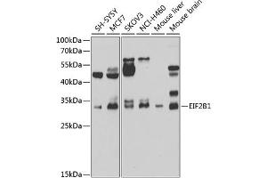 Western blot analysis of extracts of various cell lines, using EIF2B1 antibody (ABIN6132115, ABIN6140035, ABIN6140036 and ABIN6223878) at 1:1000 dilution. (EIF2B1 Antikörper  (AA 1-305))