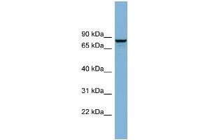 WB Suggested Anti-GGA3 Antibody Titration: 0. (GGA3 Antikörper  (N-Term))