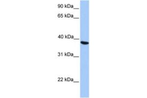 Western Blotting (WB) image for anti-N-Acetyltransferase 6 (GCN5-Related) (NAT6) antibody (ABIN2463210)