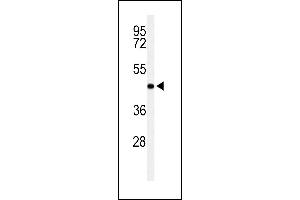 RPRD1B Antikörper  (C-Term)