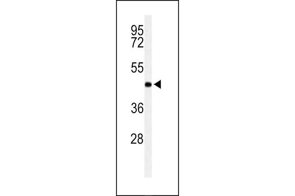 RPRD1B Antikörper  (C-Term)