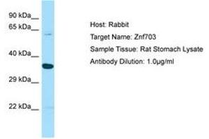 Image no. 1 for anti-Zinc Finger Protein 703 (ZNF703) (AA 513-562) antibody (ABIN6749862) (ZNF703 Antikörper  (AA 513-562))