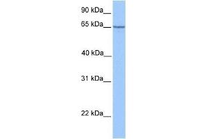 Western Blot showing PML antibody used at a concentration of 1. (PML Antikörper  (C-Term))