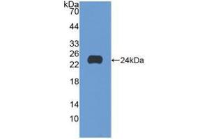Western blot analysis of recombinant Human SCFR. (KIT Antikörper  (AA 321-520))