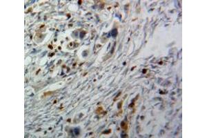 IHC-P analysis of Pancreas tissue, with DAB staining. (CDK9 Antikörper  (AA 104-315))