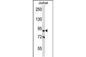 Western blot analysis in Jurkat cell line lysates (35ug/lane). (ZNF780B Antikörper  (N-Term))