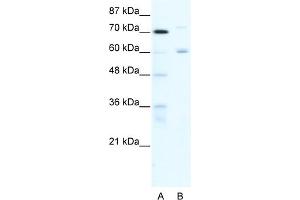 WB Suggested Anti-FOXJ2 Antibody Titration:  0. (Forkhead Box J2 Antikörper  (N-Term))