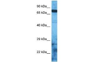 Host:  Rabbit  Target Name:  ZSC12  Sample Type:  RPMI-8226 Whole Cell lysates  Antibody Dilution:  1. (ZSC12 Antikörper  (N-Term))
