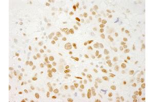 Immunohistochemistry (IHC) image for anti-Protein Quaking (QKI) (C-Term), (Isoform 5) antibody (ABIN7448749) (QKI Antikörper  (C-Term, Isoform 5))