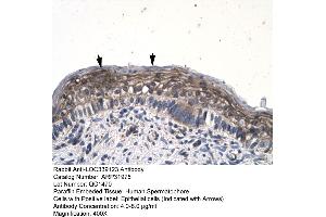 Human Spermatophore (JMJD8 Antikörper  (Middle Region))